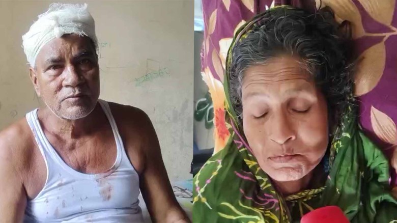 জাজিরায় দু'পক্ষের সংঘর্ষে নারীসহ আহত ২।