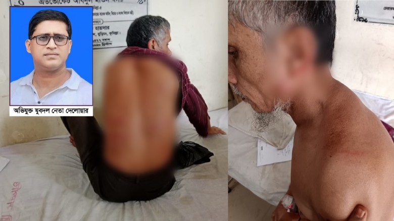 চেয়ারে বসায় বৃদ্ধ নৈশপ্রহরীকে পেটালেন যুবদল নেতা
